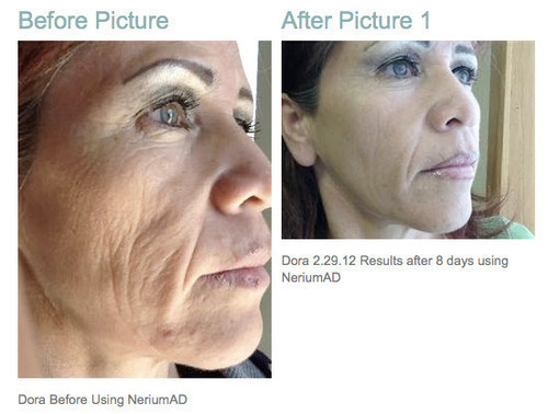 Best Wrinkle Cream Reviews - They Really do Work! | Splash ...